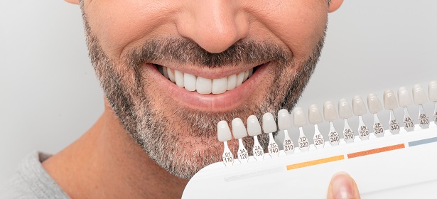 Uptown Barbershop Teeth Whitening Services